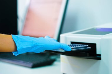 ELISA plakası, mikroplaka okuyucusuyla aşırı doz ölçecek. Biyokimya analizi için mikro plaka (96 iyi) okuyucu.