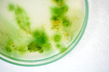 Kültür orta plakalı mavi yeşil alg kolonisi, Mikrobiyoloji.