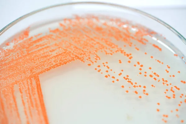 Kolonie Von Bakterien Kulturmedium Platte Mikrobiologie — Stockfoto