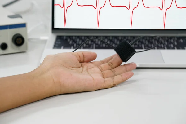 Oxímetro Pulso Dedo Que Monitorea Signo Vital Frecuencia Cardíaca Concepto — Foto de Stock