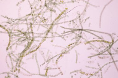 Filamentöz algler, uzun görünen zincirler, iplikler veya lifler oluşturan tek alg hücreleridir..