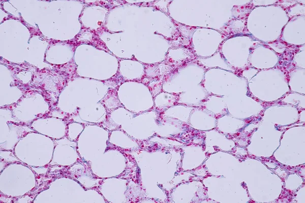 Tejido Pulmonar Humano Bajo Vista Microscopio Para Histología Educativa Tejido — Foto de Stock