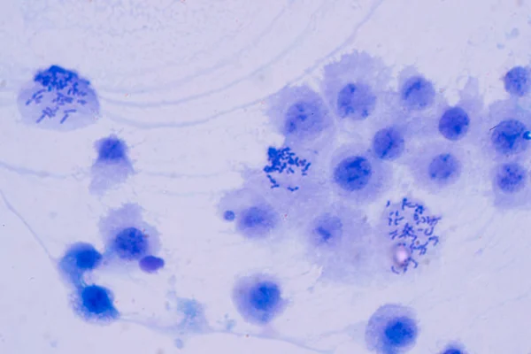 Cromosomas Humanos Bajo Microscopio Ver Para Educación — Foto de Stock
