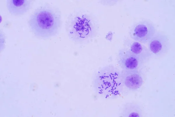 教育のための顕微鏡観察下のヒト染色体 — ストック写真