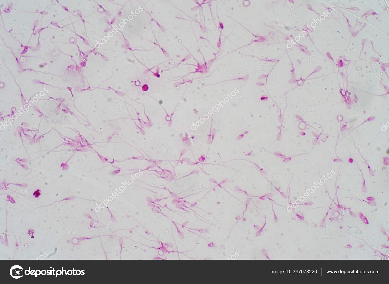 Morfologia Esperma Humano Microscópio Micrografia Mostrando