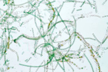 Filamentöz algler, uzun görünen zincirler, iplikler veya lifler oluşturan tek alg hücreleridir..