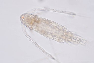 Kopepod (Zooplankton), deniz ve tatlı su habitatlarında bulunan küçük bir kabuklulardır..
