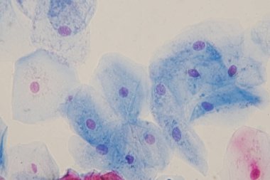 Eğitim histolojisi için mikroskop altında sineksi epitel hücreler. İnsan dokusu.