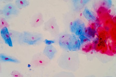 Eğitim histolojisi için mikroskop altında sineksi epitel hücreler. İnsan dokusu.