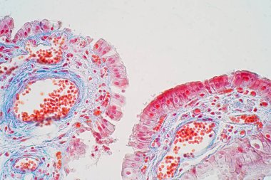 Basit bir sütun epitelyum tek katmanlı bir sütun epitelyumdur. İnsanlarda, basit bir sütun epitelyum mide, ince bağırsak ve kalın bağırsak dahil olmak üzere sindirim sisteminin çoğu organını oluşturur..