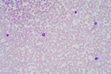 Eğitim için mikroskop altında kan hücreleri, insan dokusu, bağ dokusu