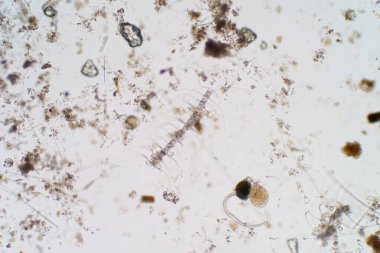 Eğitim için mikroskop altında deniz su planktonları.