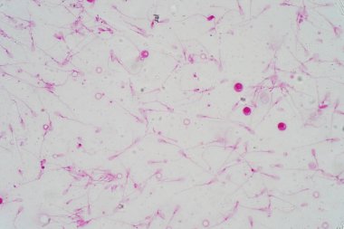 Mikroskop altında insan sperm morfolojisi. Spermatozoonları gösteren mikrograf