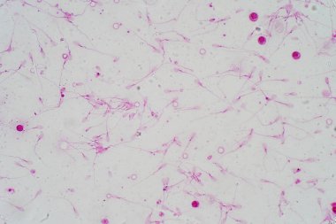 Mikroskop altında insan sperm morfolojisi. Spermatozoonları gösteren mikrograf