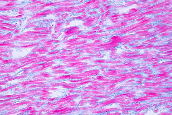 Histologie Lidského Srdečního Svalu Pod Mikroskopem Pro Výuku Lidská Tkáň — Stock fotografie