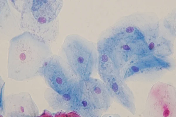 Відомі Епітеліальні Клітини Під Мікроскопом Гістології Освіти Людської Тканини — стокове фото