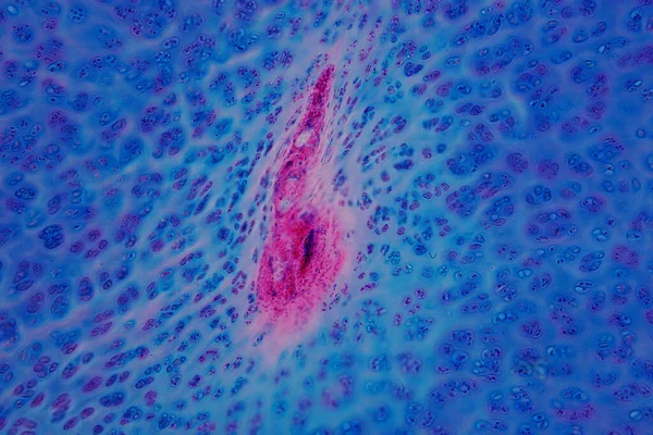 Ανθρώπινη Υαλίνη Χόνδρου Οστών Κάτω Από Μικροσκόπιο Προβολή Για Την — Φωτογραφία Αρχείου