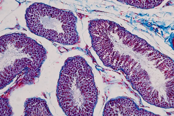 Testis Humanos Sob Visão Microscópica Mostra Espermatogonia Espermatócitos Meiose Espermatídeos — Fotografia de Stock