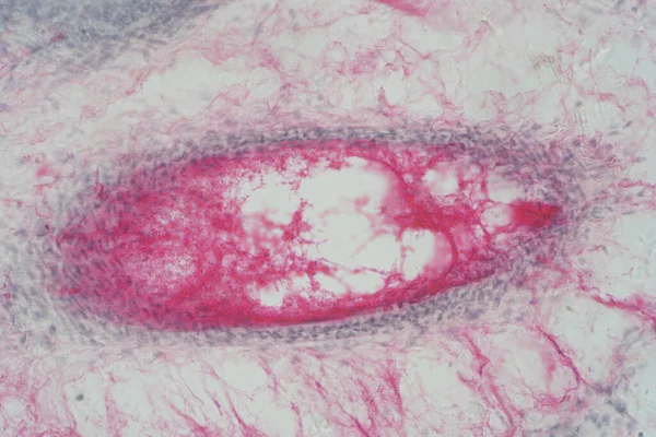Ανθρώπινος Πνευμονικός Ιστός Κάτω Από Μικροσκόπιο Πνεύμονες Είναι Κύρια Όργανα — Φωτογραφία Αρχείου