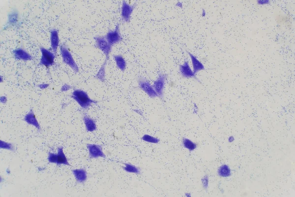 Les Cellules Neuronales Cerveau Microscope Pour Éducation — Photo