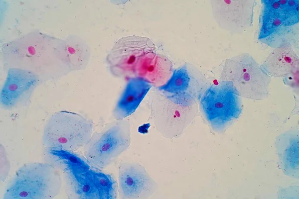 Células Epiteliais Escamosas Sob Visão Microscópica Para Estudo Histológico Tecidos — Fotografia de Stock