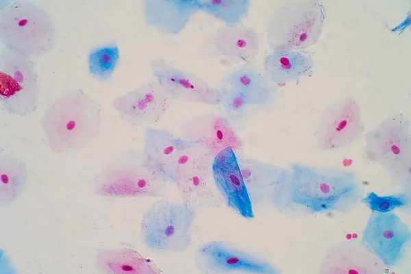 Πλακώδη Επιθηλιακά Κύτταρα Κάτω Από Μικροσκόπιο Για Την Εκπαίδευση Ιστολογία — Φωτογραφία Αρχείου