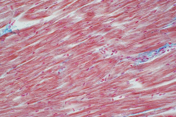 Histologie Van Menselijke Hartspier Onder Microscoop Bekijken Voor Onderwijs Menselijke — Stockfoto