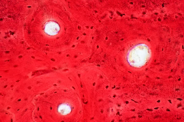 Гістологія Компактних Кісткових Тканин Людини Під Мікроскопом Навчання Язку Язової — стокове фото