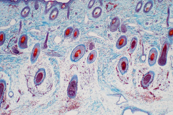 Corte Transversal Tecido Pele Humana Sob Visão Microscópica Para Educação — Fotografia de Stock