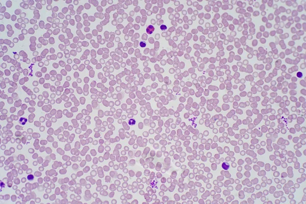 Vérsejtek Mikroszkóp Alatt Nézet Oktatás Emberi Szövet Kötőszövet — Stock Fotó