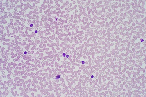 현미경으로 혈구는 인간의 조직을 줍니다 — 스톡 사진
