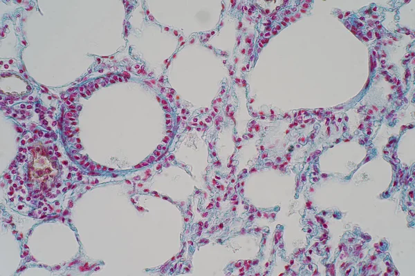 Tejido Pulmonar Humano Bajo Vista Microscopio Los Pulmones Son Los — Foto de Stock