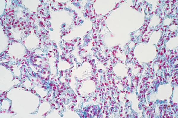 Tecido Pulmonar Humano Sob Visão Microscópica Pulmões São Órgãos Primários — Fotografia de Stock