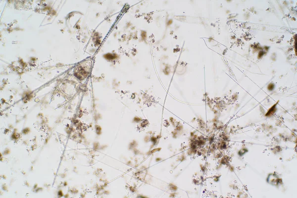 현미경으로 수있는 플랑크톤 교육에 — 스톡 사진