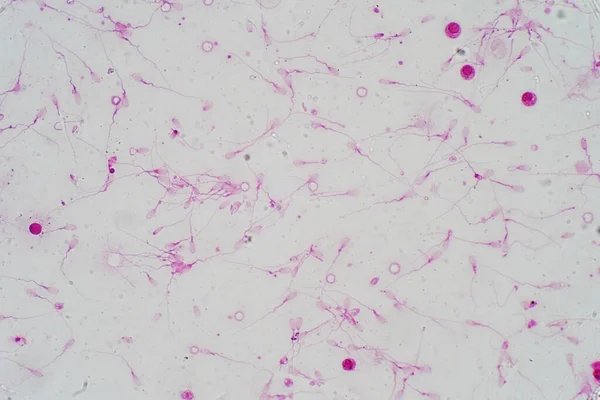 Морфология Спермы Человека Микроскопом Микрограф Сперматозоидами — стоковое фото