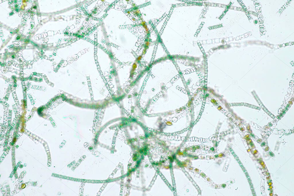 Filamentous algae are single algae cells that form long visible chains, threads, or filaments.