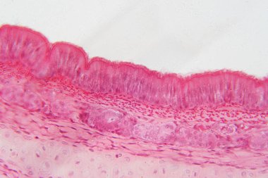 Pseudostrased epitelyum tek bir hücre katmanından oluşsa da, bir tür epitelyumdur..