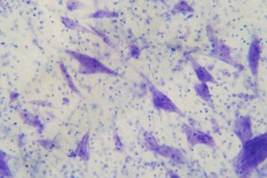 Eğitim için mikroskop altında beyindeki nöron hücreleri.