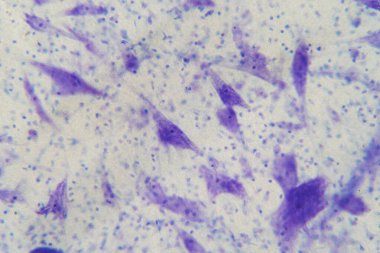 Eğitim için mikroskop altında beyindeki nöron hücreleri.