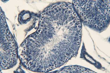 Mikroskop altında insan testisleri. Spermatogoni, mayoz, spermatid ve spermatozoa 'yı gösteriyor.