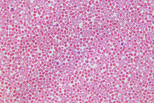 Cellules Sanguines Microscope Pour Éducation Tissu Humain Tissu Conjonctif — Photo