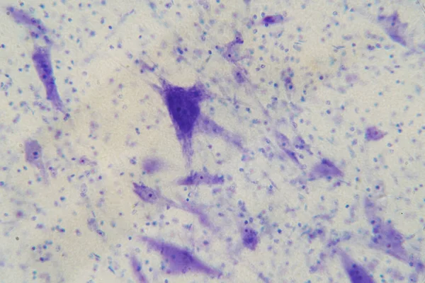显微镜下脑内神经细胞的培养 — 图库照片