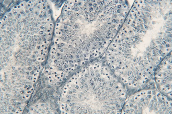 Ludzkie Jądra Pod Mikroskopem Pokazuje Spermatogonia Spermatocyty Mejozie Plemniki Spermatozoa — Zdjęcie stockowe