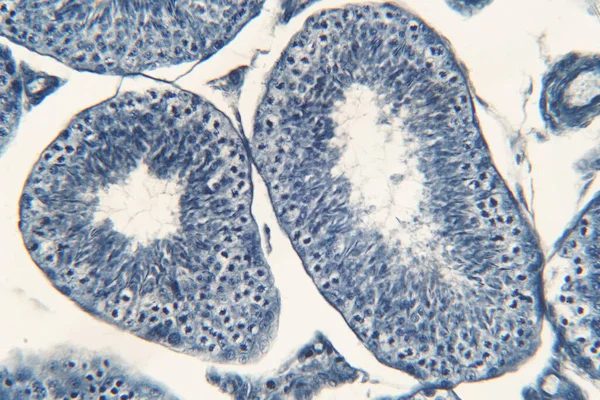 顕微鏡観察による人間の検査 表示されます精子 減数分裂の精子細胞 — ストック写真