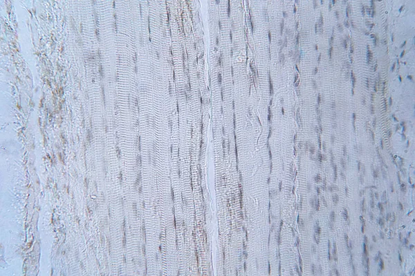 Menselijke Skeletspieren Onder Microscoop Bekijken Voor Onderwijs Histologie Menselijk Weefsel — Stockfoto