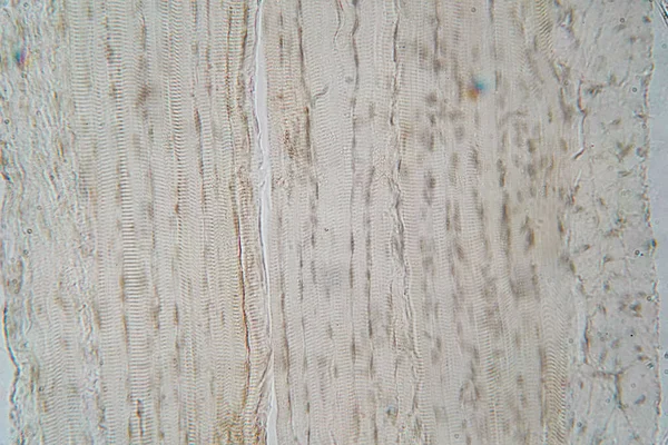 Menselijke Skeletspieren Onder Microscoop Bekijken Voor Onderwijs Histologie Menselijk Weefsel — Stockfoto