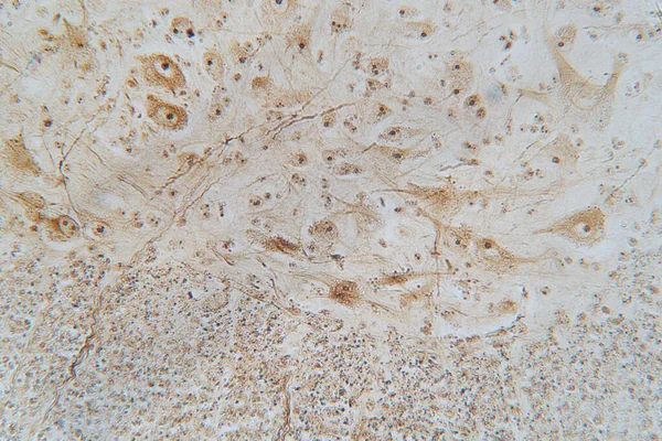 顕微鏡観察下で脊髄からの神経細胞 — ストック写真