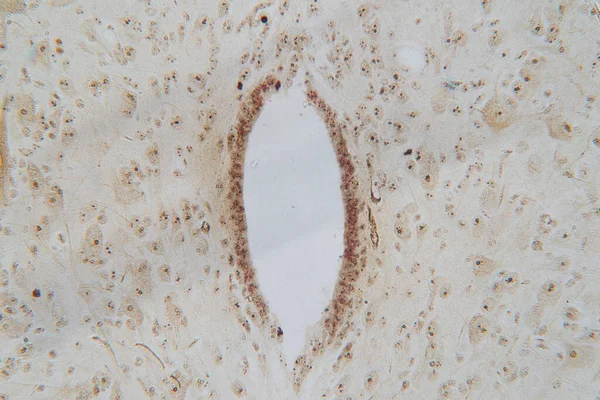 Neuronok Sejtek Gerincvelő Mikroszkóp Alatt Emberi Szövet — Stock Fotó
