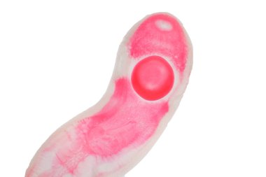 Sığır ve diğer otlayan hayvanların karaciğer kurdu (Parazit solucanı).