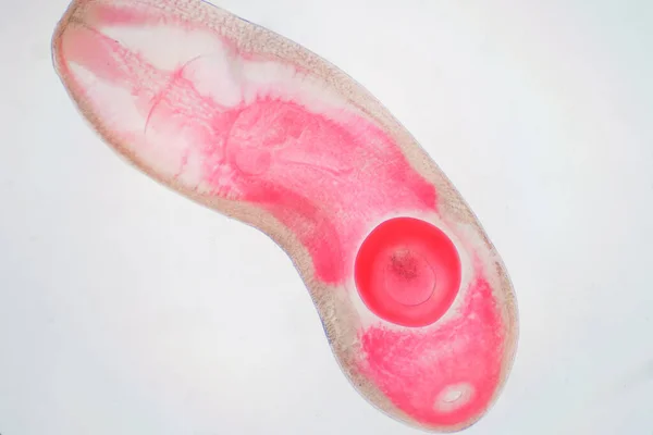 Γρίπη Του Ήπατος Parasitic Flatworm Βοοειδών Και Άλλων Χορτοφάγων Ζώων — Φωτογραφία Αρχείου